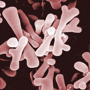 imagen de bifidobacterias, un tipo de baterias lacticas